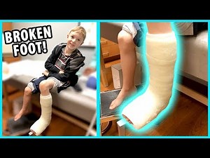 Getting a Cast! Jacob Broke His Foot - Part 2