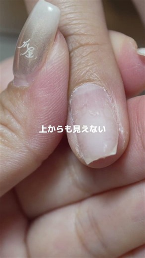 ハイポニキウム除去 #nails