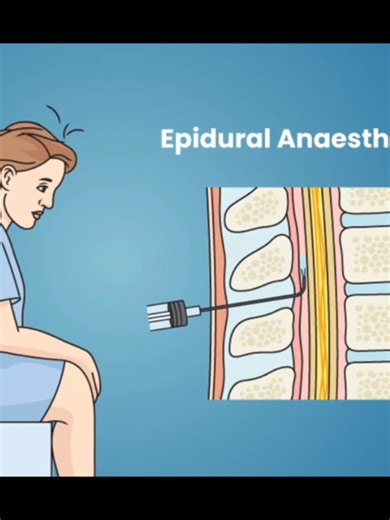 Epidural Anaesthesia Now Available for Expecting Mothers