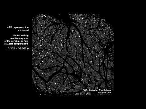 脳の宇宙を捉える顕微鏡