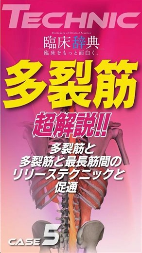 What is an effective multifidus approach for lumbar extension-type lower back pain?