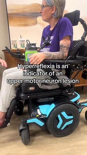 Its my super power. Hyperreflexia (abnormal increased reflexes) is a common symptom of ALS. Hyperreflexia by itself could be seen in other diseases and conditions as well. Hyperreflexia is an upper motor neuron lesion and it is not uncommon to see ALS patients turn hypo-reflexive, meaning the reflexes do not respond at all. ALS is a neurodegenerative disease that affects motor neurons in the brain and spinal cord. As the disease progresses we experience muscle weakness that eventually turns to p