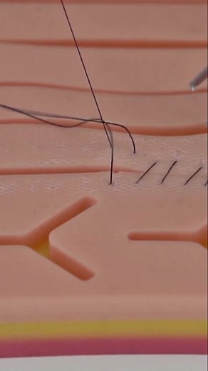 Suture Techniques: A Hands-On Medical Training Video