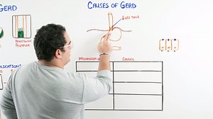 GERD Causes Pathophysiology Diagnosis Treatment | Almas Khan Roghani