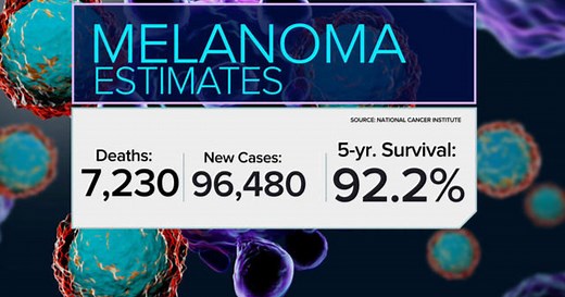 Melanoma Monday: Survival rates improving due to treatment advances