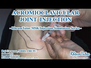 ACROMIOCLAVICULAR JOINT INJECTION: Step-By-Step Instructions