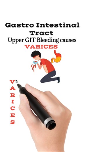 Causes of Upper Gastrointestinal bleeding