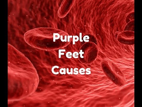 purple feet causes