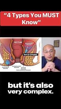 Classification and Management of Anal Abscesses and Fistulas