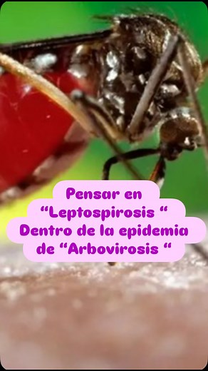 En medio de esta epidemia de arbovirosis, muchos me han preguntado si sin reactivo de laboratorio se puede diagnosticar la leptospirosis. La respuesta es SÍ. La leptospirosis se sospecha clínica y epidemiológicamente, y el tratamiento debe iniciarse sin esperar la confirmación serológica, que puede tardar días. En medicina, llegar tarde es perder tiempo valioso. Por eso, el papel del médico es actuar con criterio, pensar más allá del dengue y no dejar pasar esta enfermedad que puede ser mortal s