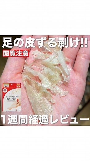 やみちゃん on Instagram: "【閲覧注意】ベビーフット後、７日間の皮むけ経過レビュー！ 🦶今回はじっくり60分タイプを使用しました。 私からの注意点は ✅パック中は滑りやすいので移動するとき、滑らないように気をつけてください。 ✅ベビーフットをする際は、大事な予定の１週間前にはしておいた方がいいと思います❗️ 詳しくは動画をご覧ください☺️ 60分のフットパックで ガサガサかかとが生まれ変わったかのようにツルツルに✨ 🦶ベビーフットイージーパック(30分/60分) 1,760円 (税込) 🦶ベビーフット カバーソックス 506円 (税込) 個人的に以前から使用しているベビーフットでPR案件を頂いたので今回は経過をしっかり説明してみました！ #PR #ベビーフット #やみちゃん #かかとケア #美容 #かかとのガサガサ #美容好きな人と繋がりたい #角質ケア #足裏パック #美容品レビュー ※効果は個人差があります。 ※柔軟化された角質が日々の歩行により剥がれてくる可能性があります。"