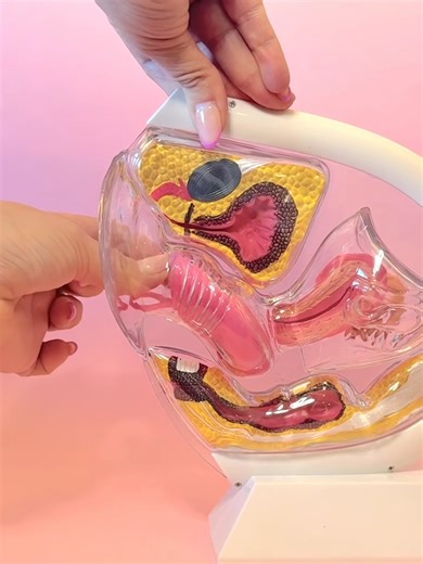 How to insert and remove a menstrual disc! 💕 #periodproducts #menstrualdisc #periodcup #hellodisc #helloperiod #periodtok #lesswaste