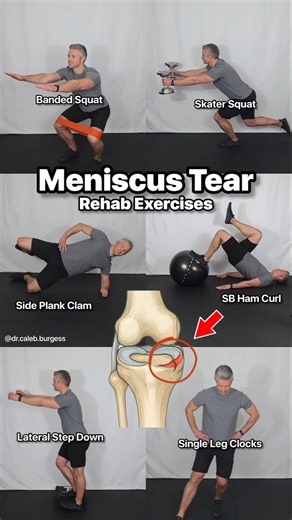 Meniscus Tear - Rehab Exercises