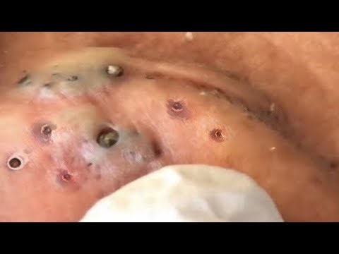 𝑺𝒐𝒐𝒕𝒉𝒊𝒏𝒈 𝑭𝒂𝒄𝒊𝒂𝒍 𝑻𝒓𝒆𝒂𝒕𝒎𝒆𝒏𝒕 𝒇𝒐𝒓 𝑺𝒕𝒓𝒆𝒔𝒔 𝑹𝒆𝒍𝒊𝒆𝒇 | 𝑫𝒆𝒆𝒑 𝑪𝒍𝒆𝒂𝒏𝒊𝒏𝒈 & 𝑪𝒂𝒍𝒎𝒊𝒏𝒈 𝑴𝒂𝒔𝒔𝒂𝒈𝒆 𝒂𝒕 𝑳𝒖𝒙𝒖𝒓𝒚 𝑺𝒑𝒂 #758436