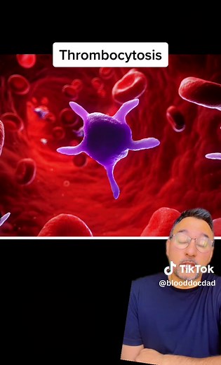 High Platelets: Causes, Symptoms & Treatment | Hematologist Explains