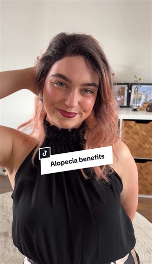 Embrace Your Baldness: Benefits of Alopecia