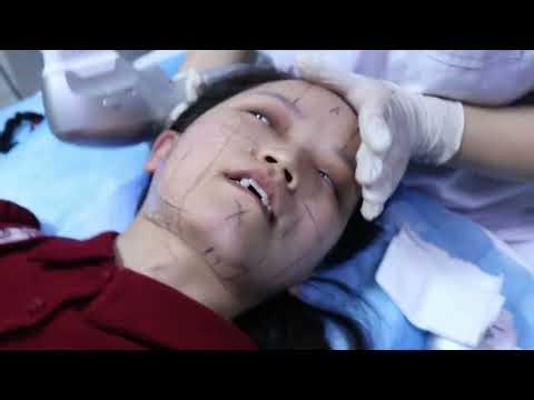 How to use the 7d hifu machine