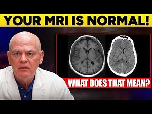 What Radiologists See in a Healthy Brain MRI
