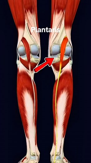 413K views · 3.5K reactions | Plantaris #muscle #anatomy 例️‍♀️ | Dr. Ishtiaque Arafat | Facebook