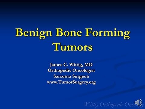 Orthopedic Oncology Course - Benign Bone Forming Tumors (Osteoblastoma, Osteoid Osteoma) - Lecture 3
