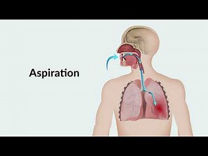 IDDSI Framework Overview with Dole