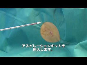 研修医教育ビデオシリーズ⑦ 胸腔ドレーン