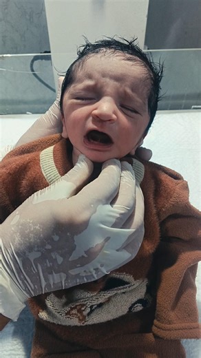 Newborn Baby Head to Toe Assessment 👶🩺 | NICU Nurse Examination Guide #baby#NewbornAssessment