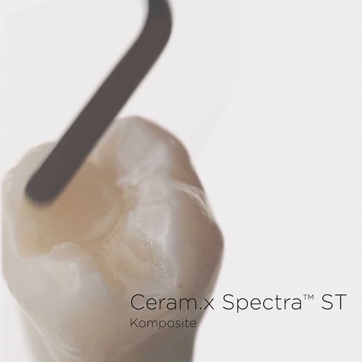 Mit der Ceram.x Spectra ST Komposit-Familie bieten wir Ihnen echte Allround-Talente – ob als Universal-Komposit für Ihre meisten Fälle, mit Effekt-Farben für komplexe Frontzahnfälle oder als Flowable. Erfahren Sie mehr: dentsplysirona.com/ceramx | Dentsply Sirona