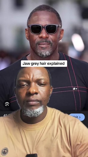 Reverse Grey Hair: Solutions, Remedies & Tips for Healthy Hair