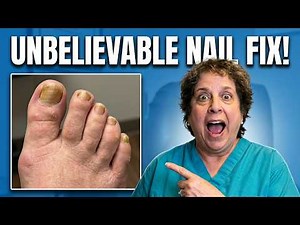 Severe Leg Swelling, Lymphedema & Toenail Care | What Really Helps?