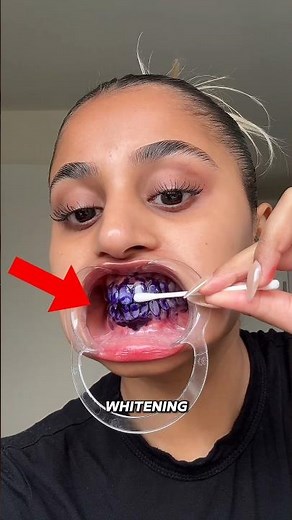 How Teeth Whitening Strips Work So Fast 😬✨ #TeethWhitening #DentalCare