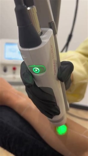 Efficiënte Laserontharing met Gentlemax Pro