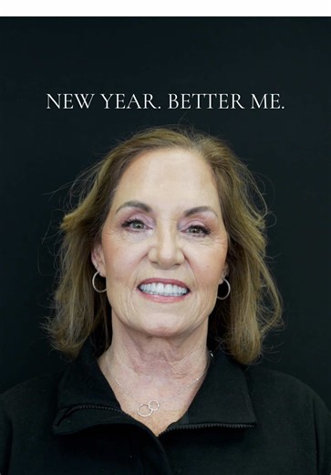 New year, better you 🤍 This non-surgical lower third facelift shows how adjusting your smile and bite can transform your entire face. We achieved this by placing 24 porcelain veneers with NO PREP to her natural teeth! #cincinnati #cincinnatidentist #allsmilesdentalstudio #smilemakeover #veneerscheck