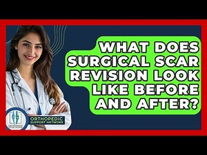 What Does Surgical Scar Revision Look Like Before And After? - Orthopedic Support Network