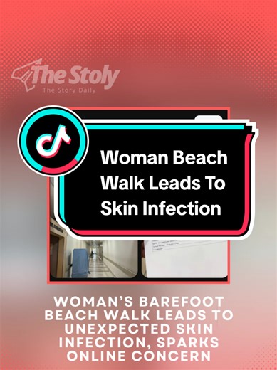 What started as a relaxing barefoot stroll along the beach quickly turned into a worrying health scare for one woman. In a viral social media post, the woman shared how she initially went to a clinic seeking treatment for persistent itching on both of her feet. Medical notes later revealed that the symptoms began after she had walked barefoot on sandy areas near the beach. According to explanations shared by other users online, such symptoms may be linked to cutaneous larva migrans, a parasitic 