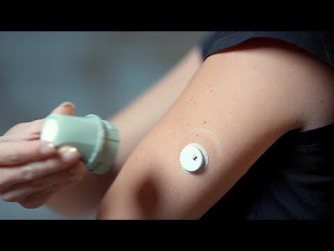 LinX CGM for Real-Time Blood Glucose Alerts: Maximum Privacy, Ultimate Monitoring