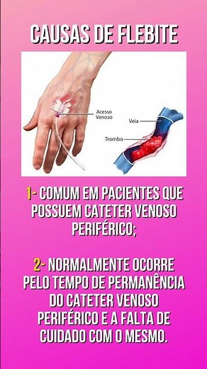 CAUSAS DE FLEBITE #shorts