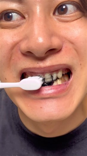 やばい この黒い炭歯磨き粉使ったら頑固な黄ばみが....#メンズ #ホワイトニング #歯磨き粉 #美容 #歯石 PR