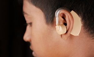 Cochlear Implants Can Bring the Experience of Sound to Those With Hearing Loss, but Results May Vary – Here’s Why