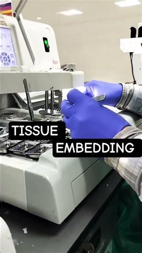 #Pathology#HistopathologyLab#MedTech#HealthCare#LabIndia#MedicalReels #histopathology