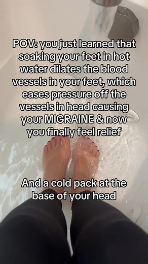 Migraine Relief. A natural way to ease your pain. Try this to get rid of your migraine. #migraine #headache #trend #viral #migrainerelief #fyp #fypシ #tt #health #wellness