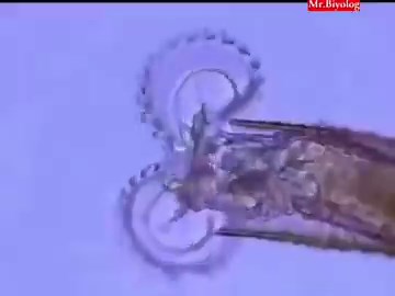 This aquatic microorganism is called Bdelloid Rotifer. It has chainsaw like mouth.