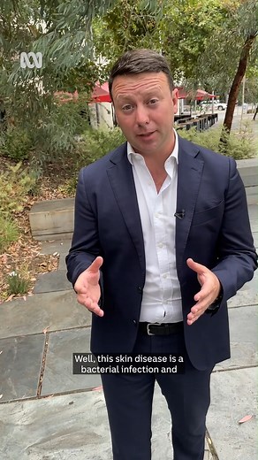 Scientists say they've confirmed a long-suspected link between mosquitoes and the spread of the flesh-eating bacteria that causes the Buruli ulcer. 🎤: Mike Lorigan #Mosquito #BuruliUlcer #Victoria #ABCNews | ABC Melbourne