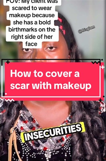 Cómo resaltar la belleza de las marcas de nacimiento