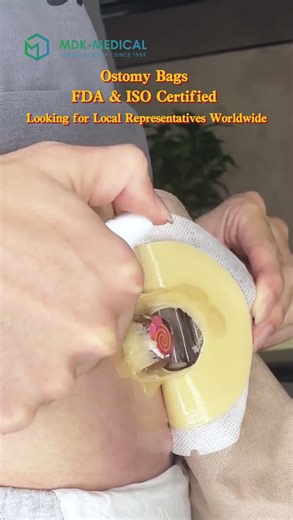 High-Quality Ostomy Bag Production for Global Medicine