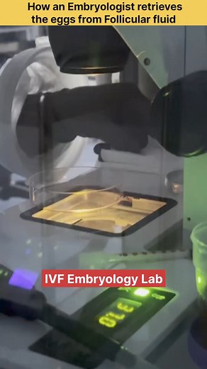 3.1K views · 12 reactions | How an Embryologist retrieves the eggs from Follicular fluid, IVF Egg Retrieval #embryology #embryologist #embryologylab #eggretrieval #ovumpickup #ivftreatment #ivfprocess #ivfsuccess #ivfjourney #indiraivfhisar #IndiraIVF | Medication Knowledge | Facebook