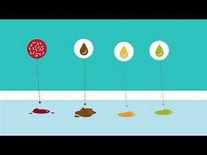 Hospital Spill management Kit for Blood, Urine, Vomit, Mercury & Chemical