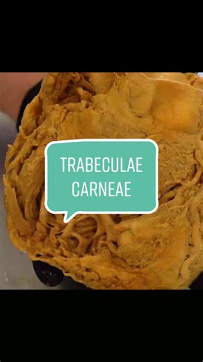 The dripping fluid is Phenoxyethanol — the wetting agent used to maintain the dissections. Just FYI... #Heart #Anatomy #ScienceClass #Education