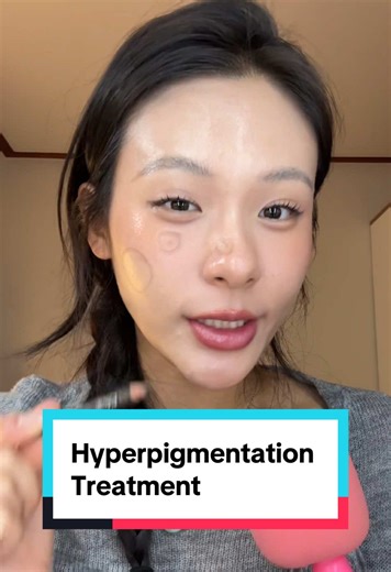 Effective Hyperpigmentation Treatment Solutions
