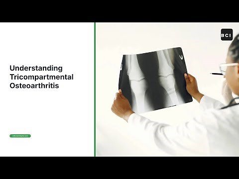 Understanding Tricompartmental Osteoarthritis